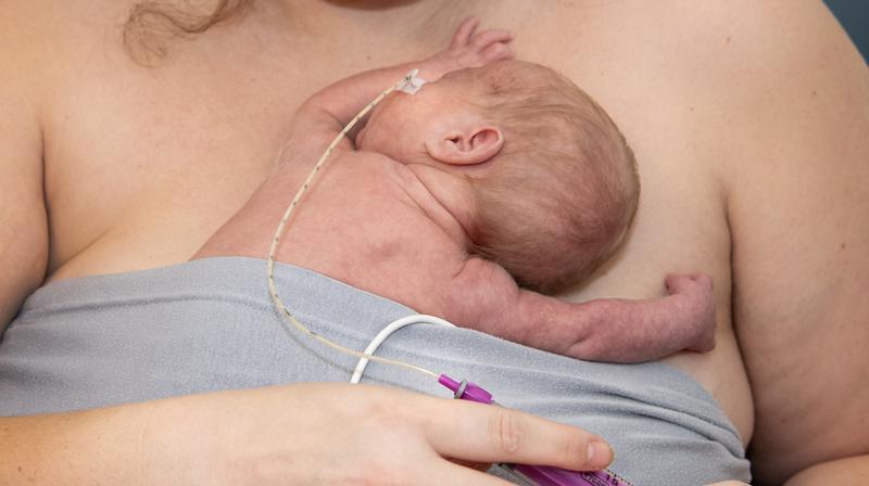 På neonatalavdelningen USÖ, bilder från verksamheten