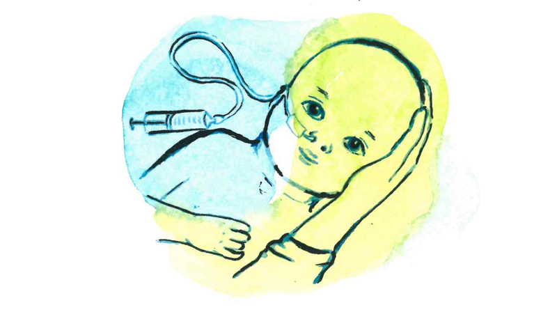 Illustration. En bebis som sondmatas.